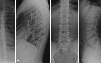 A Patient’s Guide To Chiropractic Imaging