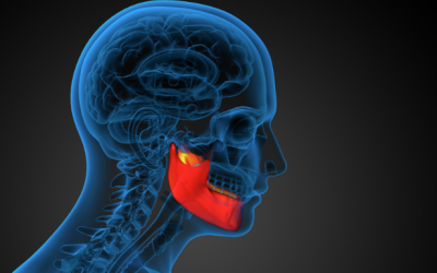 Understanding TMJ Pain and Jaw Tension